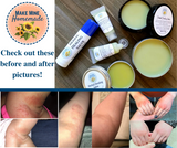 Herbal Healing Salve